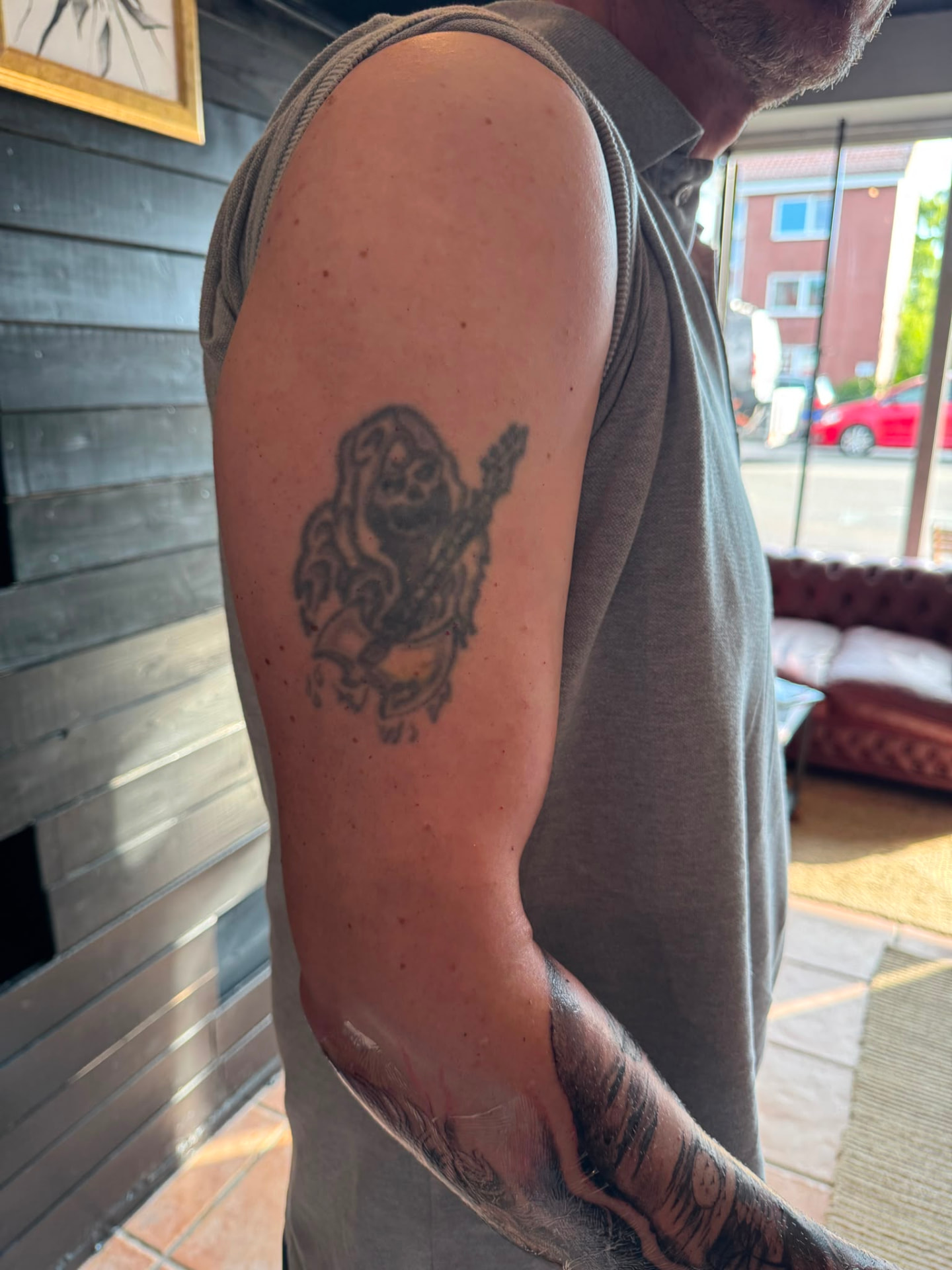 Cover-up · Oberarm – vorher
