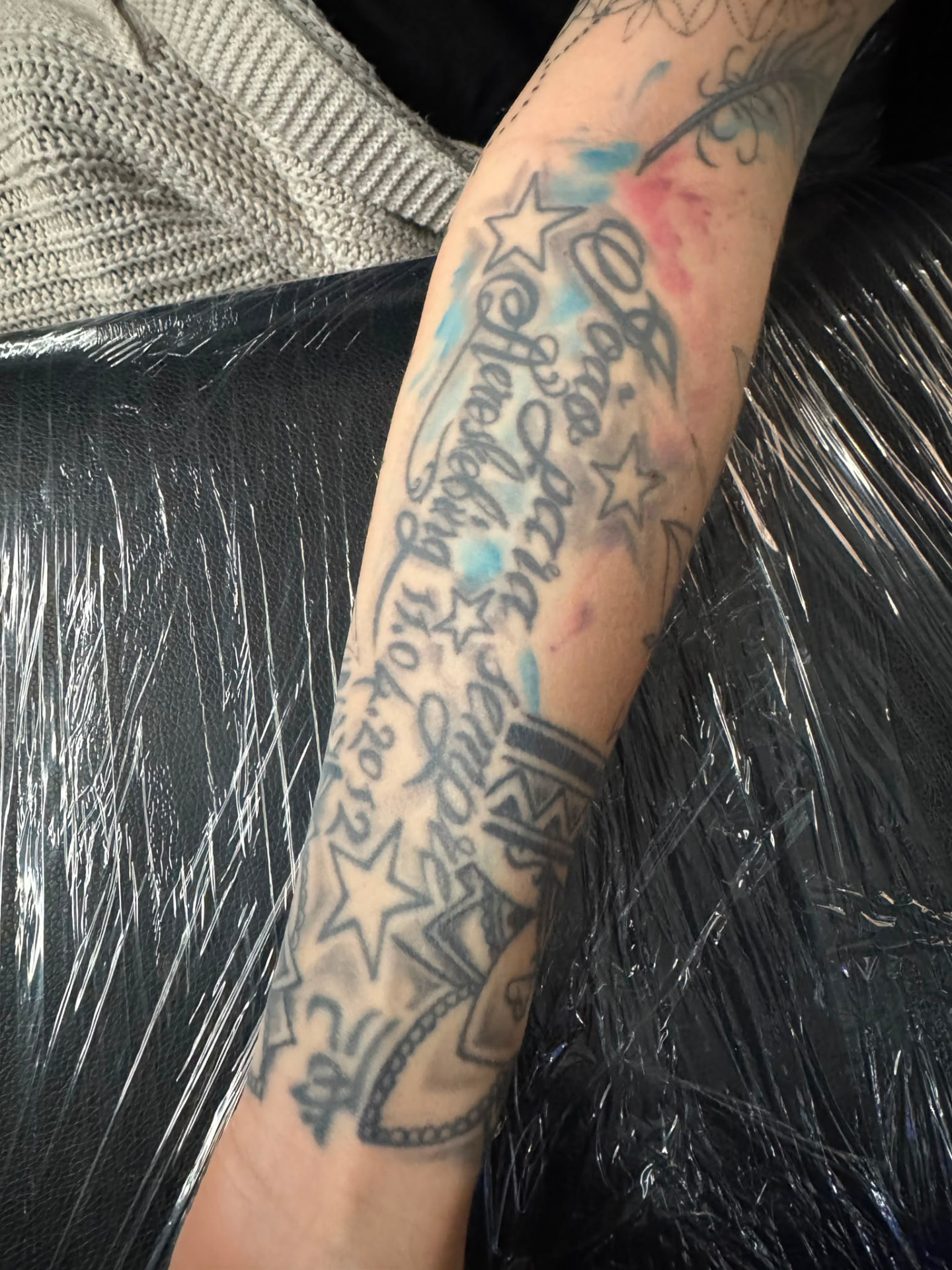 Cover-up · Unterarm – vorher