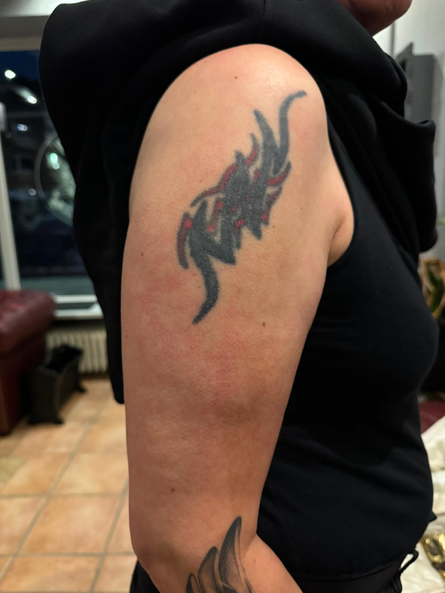 Cover-up · Oberarm – vorher