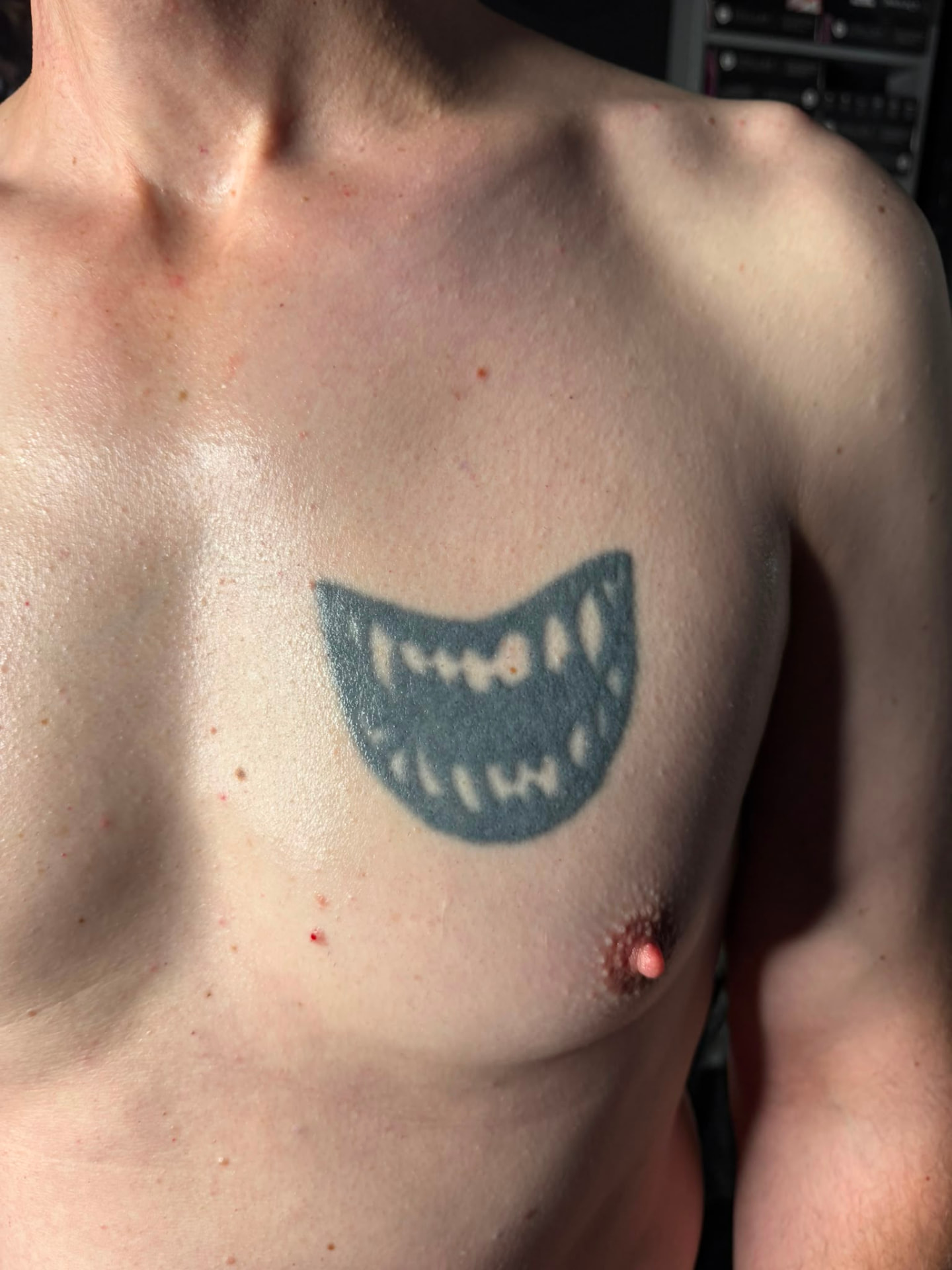 Cover-up · Brust – vorher