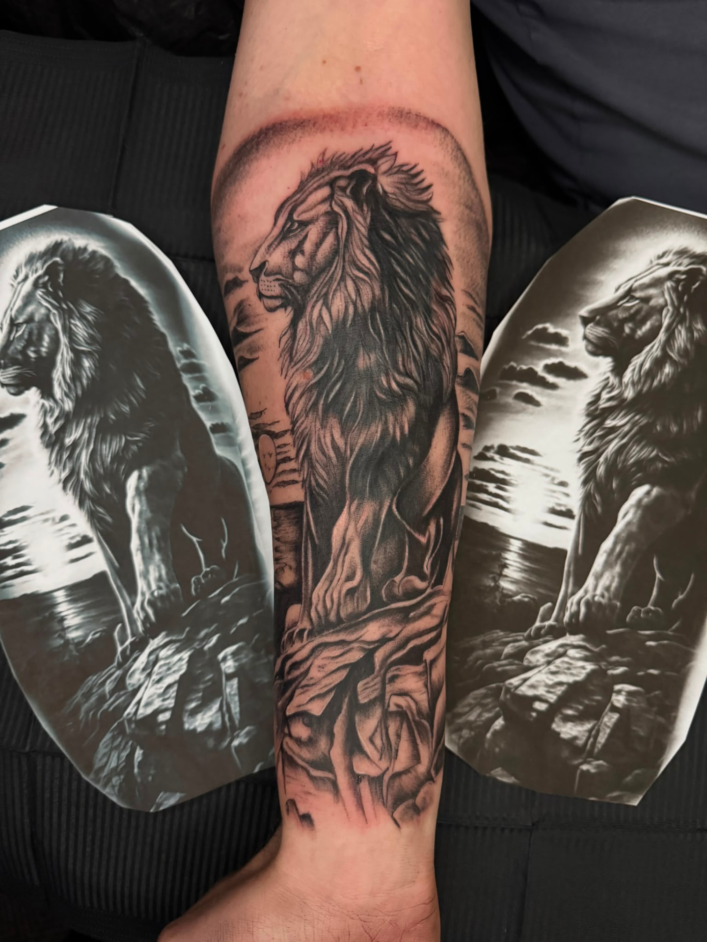 Cover-up · Bein – nachher