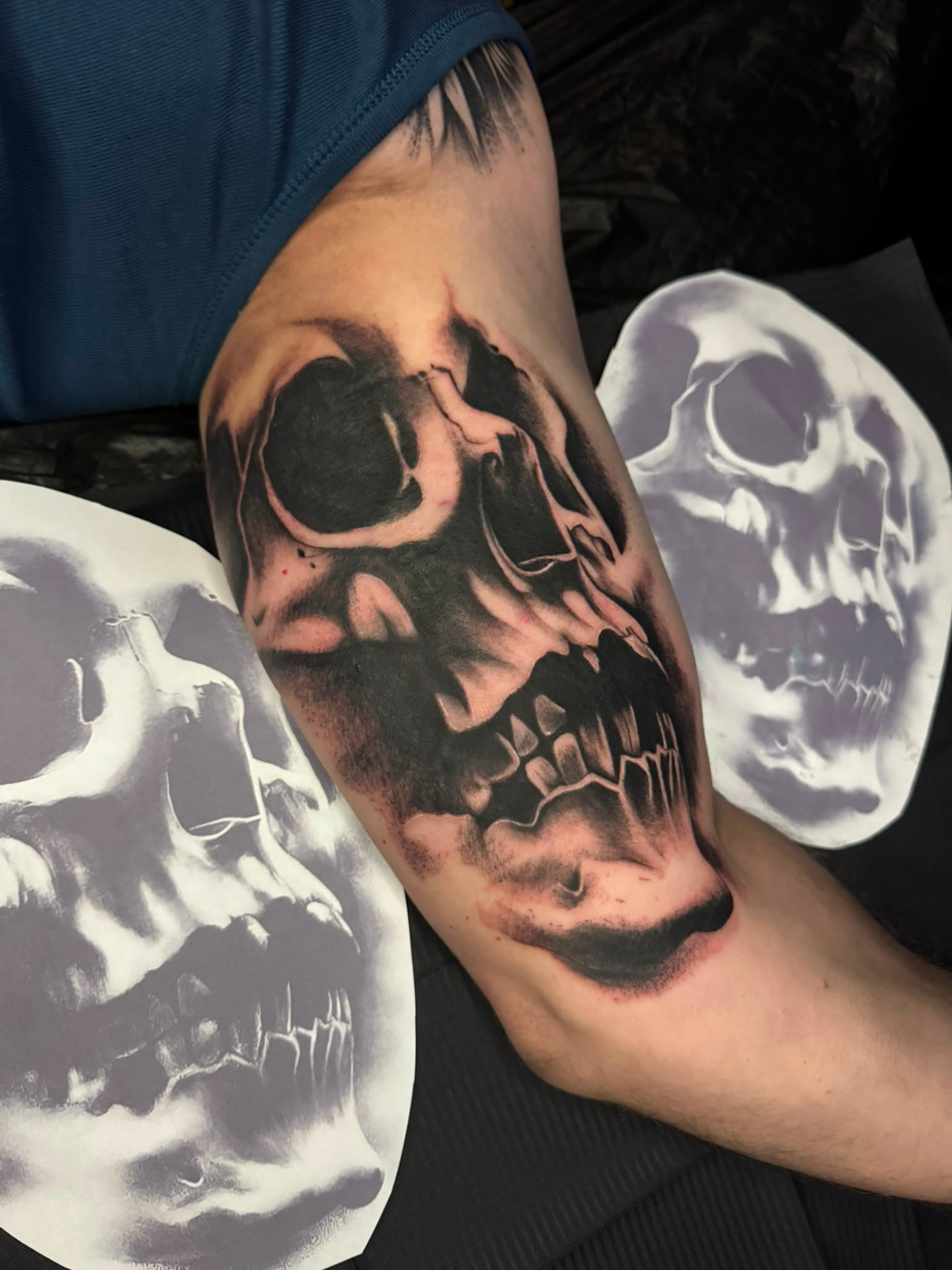 Cover-up · Oberarm – nachher