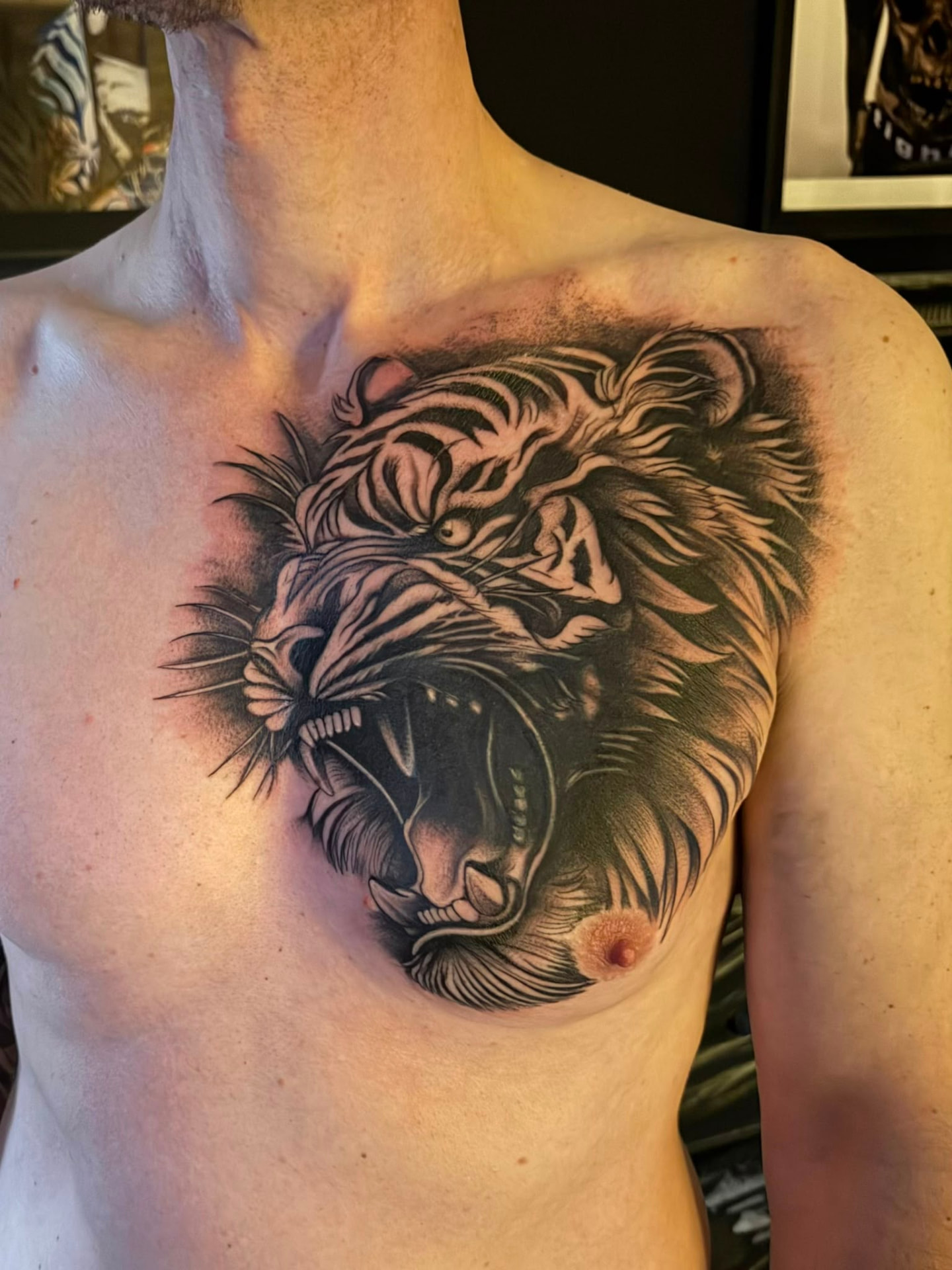 Cover-up · Brust – nachher