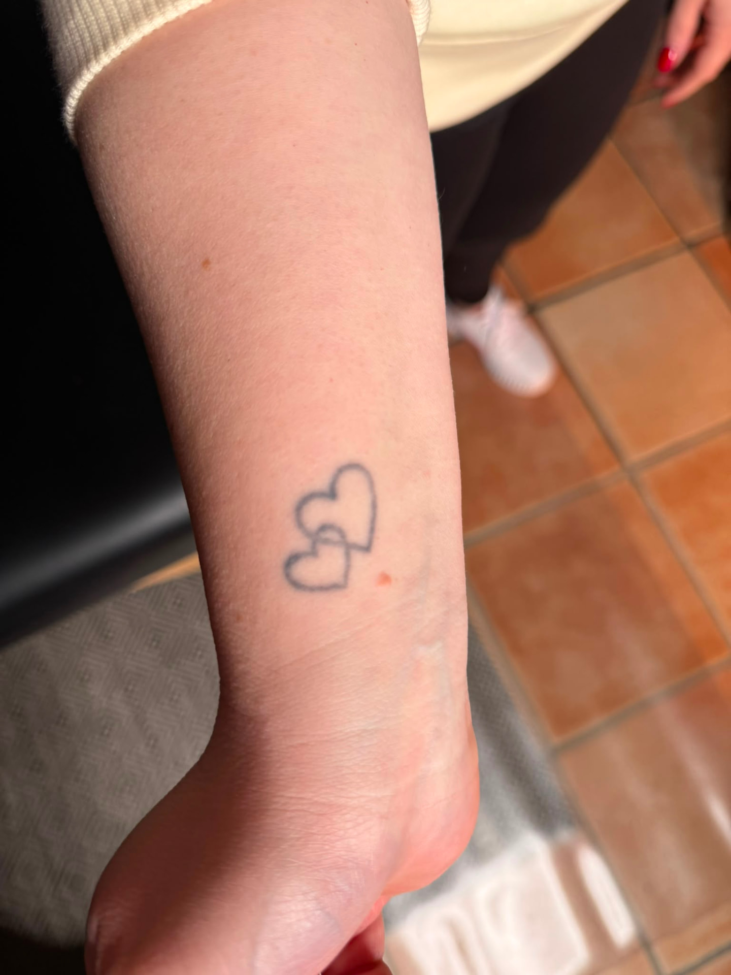 Cover-up · Handgelenk – vorher