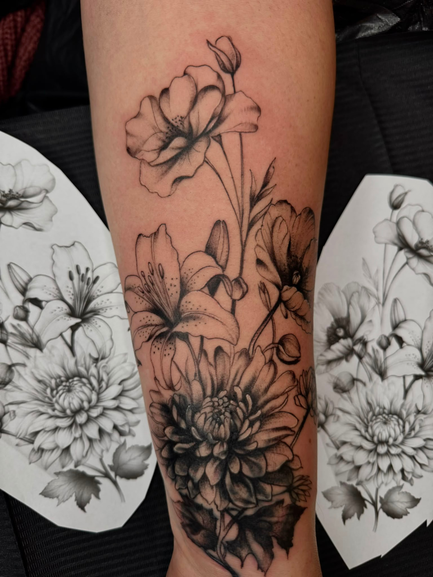 Cover-up · Unterarm – nachher