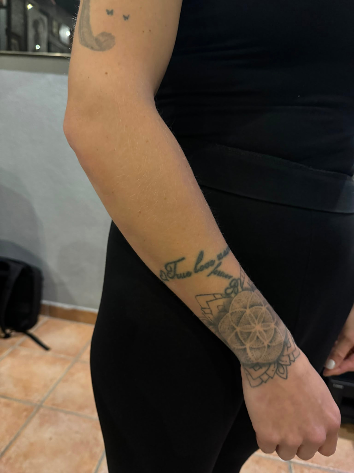 Cover-up · Unterarm – vorher